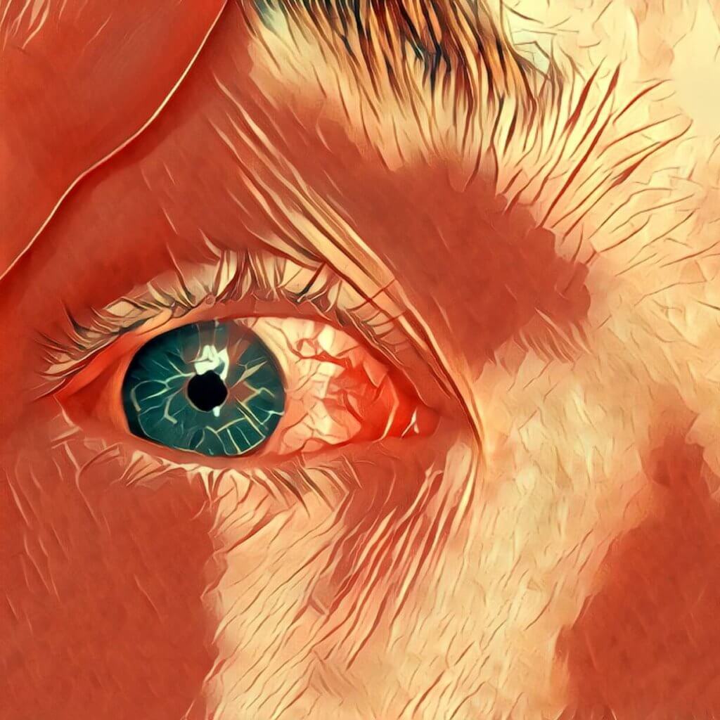 Traumdeutung Augen Geschlossen Lassen Sich Nicht öffnen Augen | Traum-Deutung