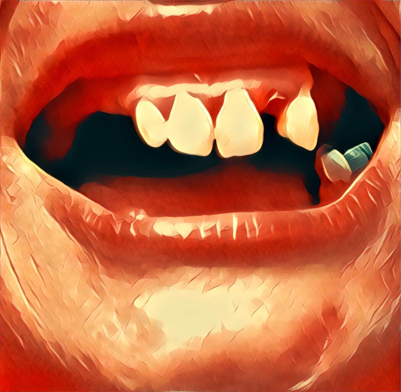 Zähne Traumsymbol mit Video TraumDeutung